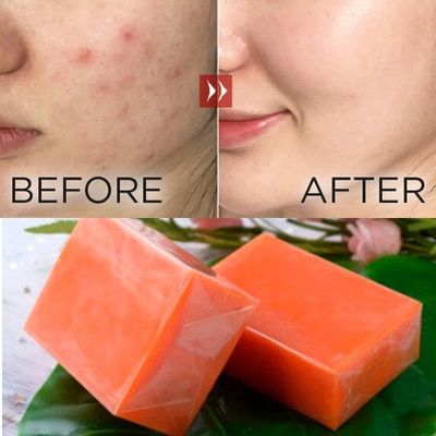 Vagina Tightening and Detox Yoni Whitening Soap Bar NO Medicated 2 Years Shelf Life