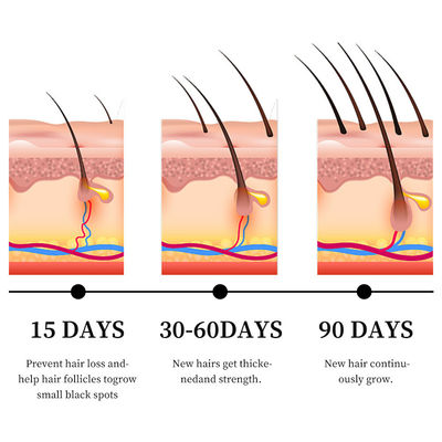 Potent Anti Hair Loss Treatment Serum with Ginger Oil and Vitamin B5