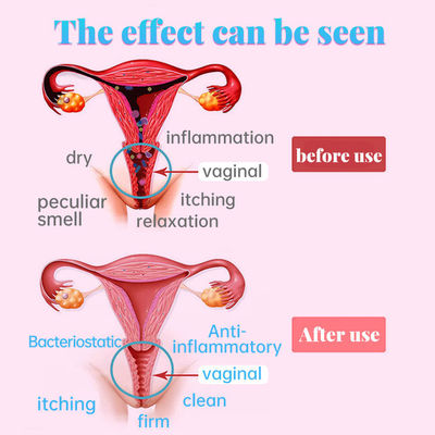 Vaginal Care Products for Women's Health Function Narrowing Vagina 2 Years Shelf Life
